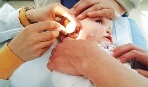 Viêm V.A là bệnh lý tai mũi họng rất thường gặp ở trẻ em nhỏ 1 - 5 tuổi. 